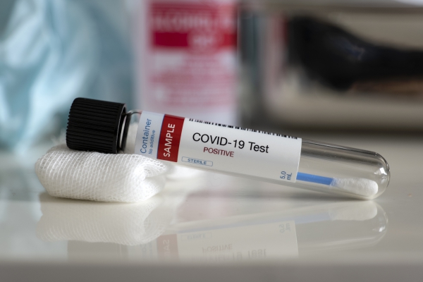 Photo for COVID 19 Testing at Health Department
